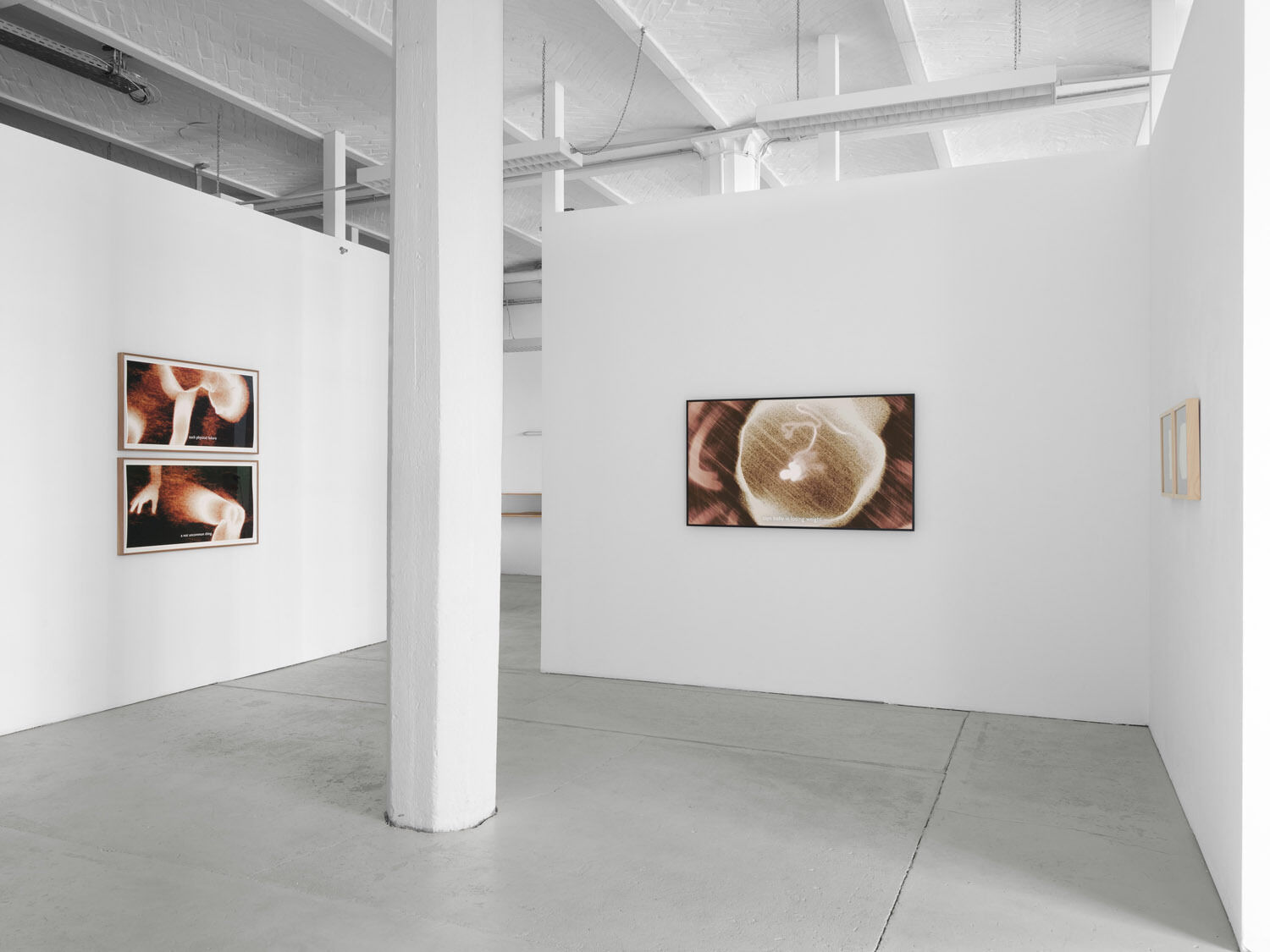 Ana Maria Caballero, Echo Graph, 20225